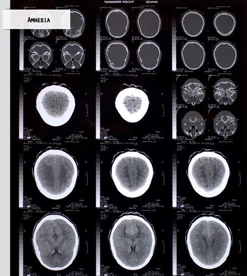 Image:Amnesia.jpg
